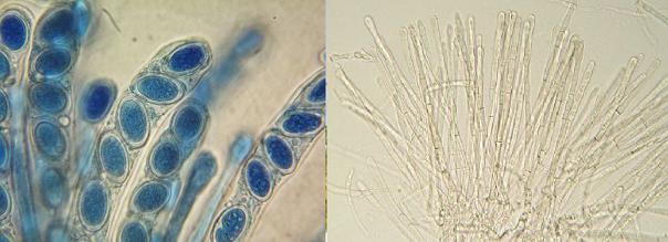 Fotos microscopio optico de ascas y de parafisis